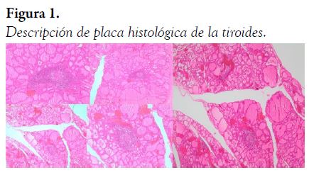 Descripción de placa histológica de la tiroides.