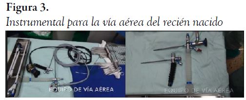 Instrumental para la v&iacute;a a&eacute;rea del reci&eacute;n nacido