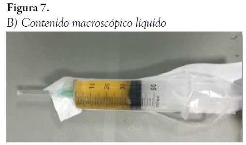 B) Contenido macrosc&oacute;pico l&iacute;quido