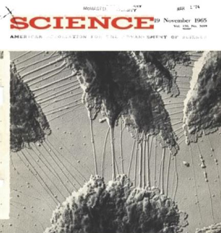 El artículo publicado por Melzack y Wall, relacionado con los principios básicos del entendimiento del dolor fue tan importante que me parece relevante, como evidencia histórica, incluir en este trabajo. La foto tomada por el autor (JCA) de la portada de la revista en que dicho artículo fue publicado. No busco con dicha imagen ampliar el conocimiento del lector respecto al manejo del dolor, sino permitir asociar una imagen con el evento histórico de la descripción de la teoría de la compuerta. Hay que recordar que es el artículo más referenciado en la historia de la medicina.