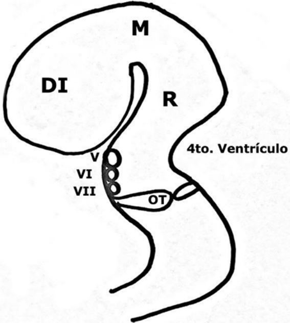 Embrión de 16 semanas que muestra la posición de los núcleos VI y VII pares en relación con la flexión del romboencéfalo que puede llevar a afectar la perfusión y producir muerte celular en los núcleos craneales VI y VII, cuando diferentes factores pueden contraer el músculo liso, lo cual lleva a posiciones anómalas del embrión en relación con el útero y a flexión de áreas susceptibles
