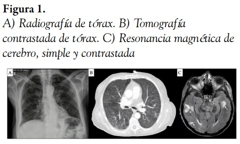 A) Radiografía de tórax. B) Tomografía contrastada de tórax. C) Resonancia magnética de cerebro, simple y contrastada