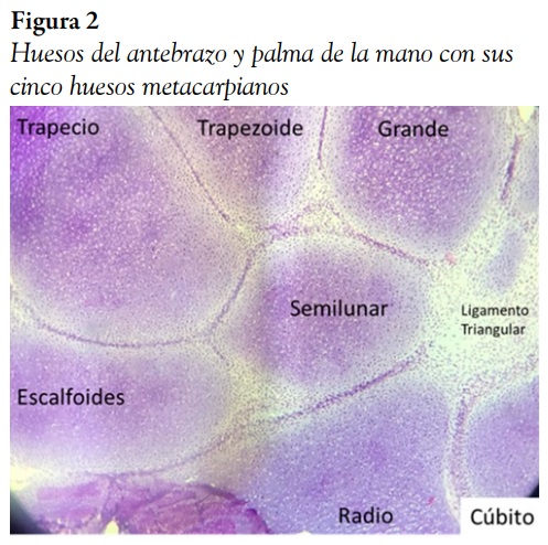 Huesos del antebrazo y palma de la mano con sus cinco huesos metacarpianos