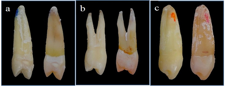 Estudio cl&iacute;nico
de la superficie del esmalte. a. Control negativo, b. Control positivo, c.
Grupo experimental (comparaci&oacute;n de la muestra 9 de cada grupo)