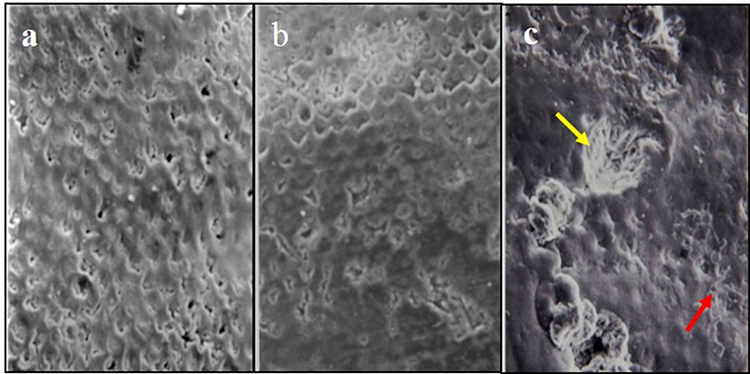 Estudio ultraestructural de la superficie del esmalte