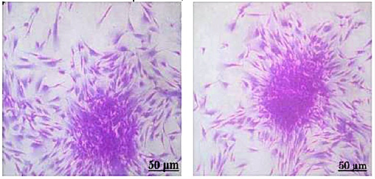 Microfotograf&iacute;as de las UFC-F a la semana de expansi&oacute;n
celular despu&eacute;s de criopreservaci&oacute;n