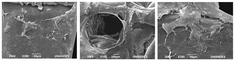 Evaluaci&oacute;n de la adhesi&oacute;n de las CTPD al sustrato de APL
por SEM a 300X, 100X y 350X