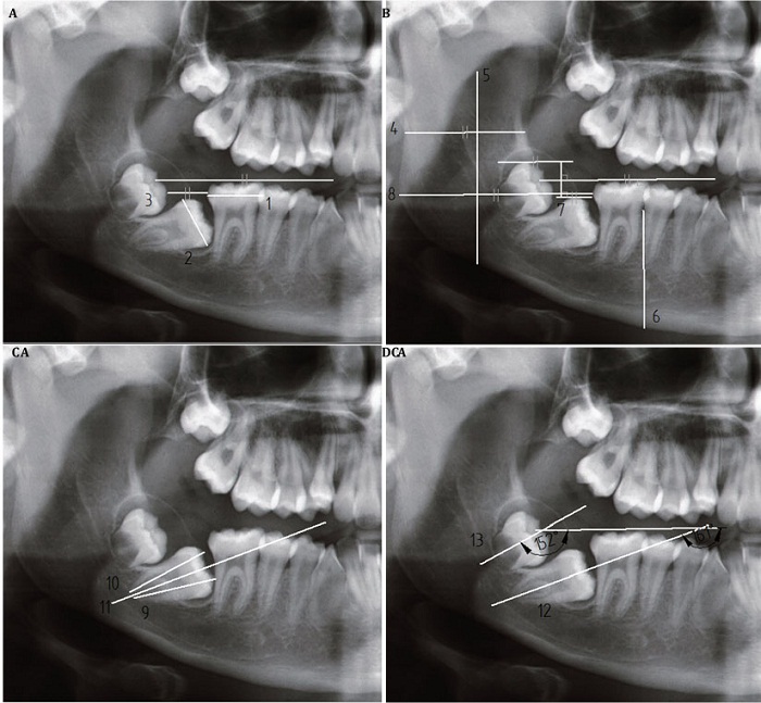Par&aacute;metros
dentoesquel&eacute;ticos