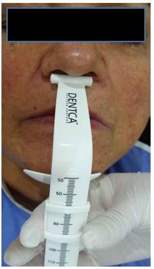 Toma de la dimensi&oacute;n vertical