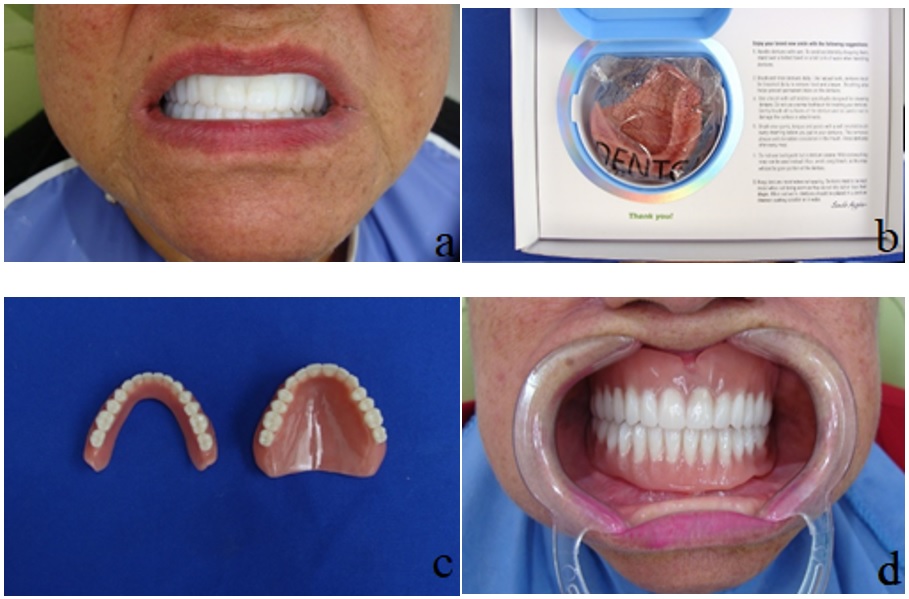 a) Prueba de set-up. b) Presentaci&oacute;n final del laboratorio. c) Pr&oacute;tesis terminadas. d) Caso entregado