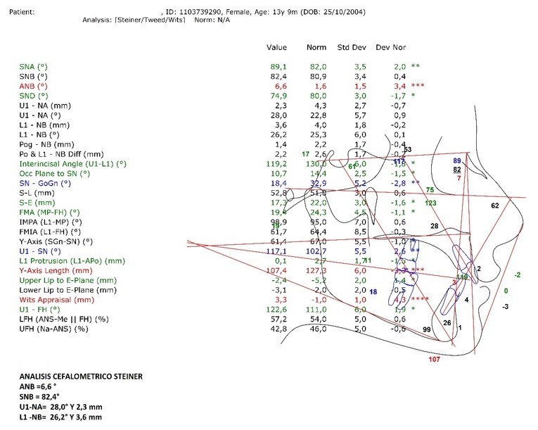 An&aacute;lisis cefalom&eacute;trico de Steiner