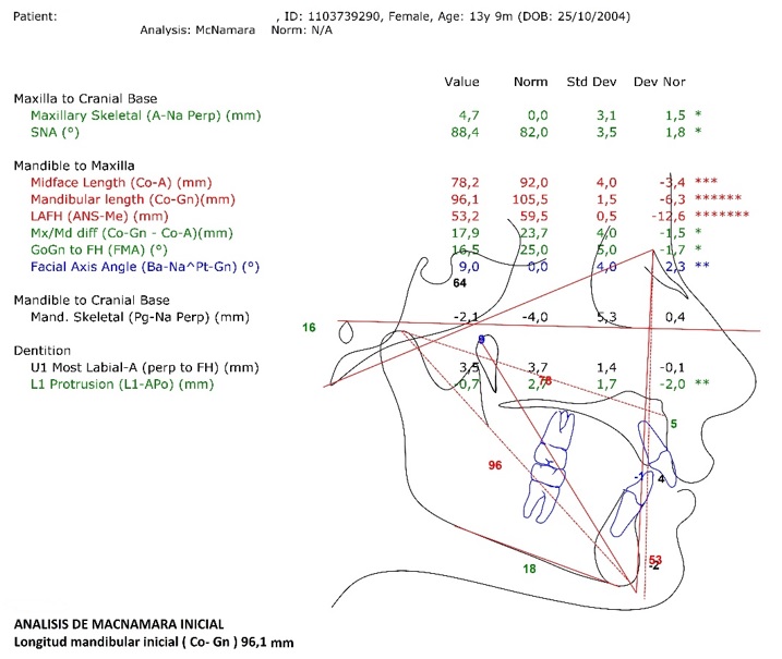 An&aacute;lisis cefalom&eacute;trico de McNamara