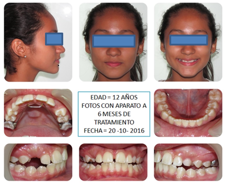 Fotograf&iacute;as de la paciente un a&ntilde;o despu&eacute;s