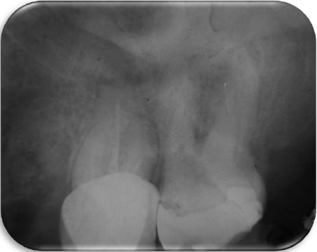 RADIOGRAF&Iacute;A INICIAL