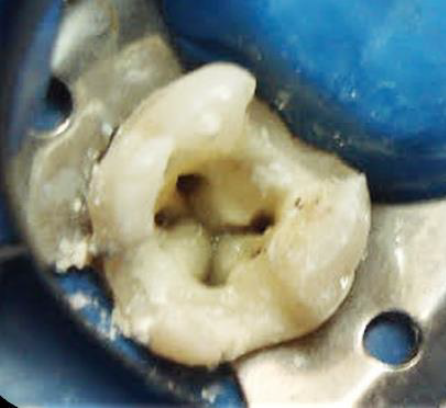 ACCESO DONDE SE MUESTRA LA ENTRADA DE LOS CUATRO CONDUCTOS