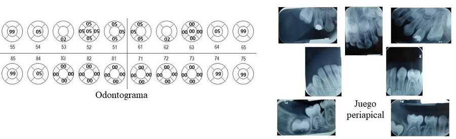 ODONTOGRAMA Y JUEGO PERIAPICAL