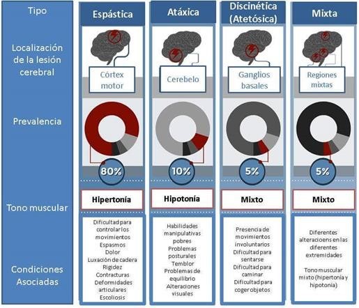 FORMAS CL&Aacute;SICAS DE CLASIFICAR LA PAR&Aacute;LISIS CEREBRAL. COPYRIGHT 2019 POR EFISIOPEDIATRIC. 2016 [CITED 11 OCTOBER 2019]. AVAILABLE FROM: HTTPS://EFISIOPEDIATRIC.INFO/WP- Importar imagenCONTENT/UPLOADS/2016/10/CUADRO-TIPOS.JPG/