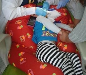 INSTRUCCIONES DE POSICI&Oacute;N DEL PACIENTE PARA EL CEPILLADO