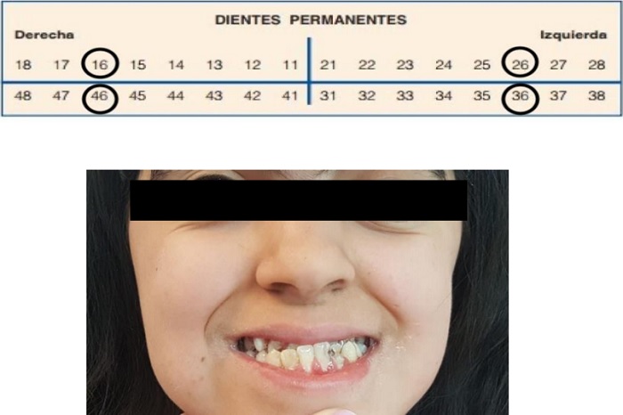 VISI&Oacute;N INTRAORAL PARCIAL