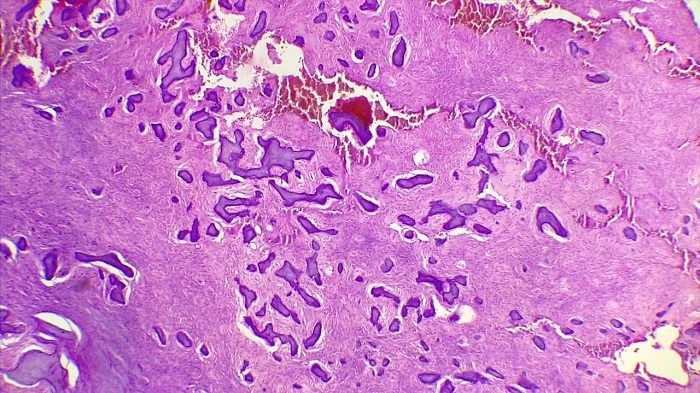 VISTA MICROSC&Oacute;PICA DE LA MUESTRA &Oacute;SEA