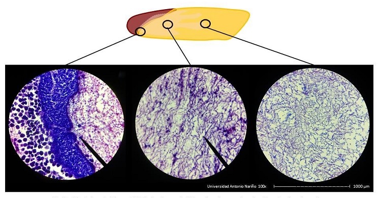 ANLISIS HISTOLGICO DE LAS ZONAS DEL PRF