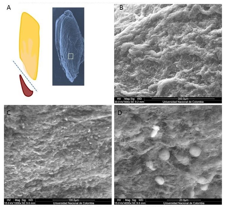 ANLISIS DE MICROSCOPA ELECTRNICA DE BARRIO DEL PRF