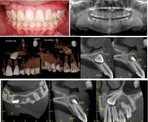 Initial Records Photography, Orthopantomography and Cone Beam Tomography, Case 1