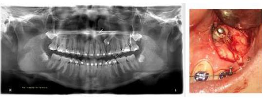 Follow-up Images, Case 1