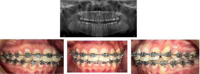 Completion Records, Case 1