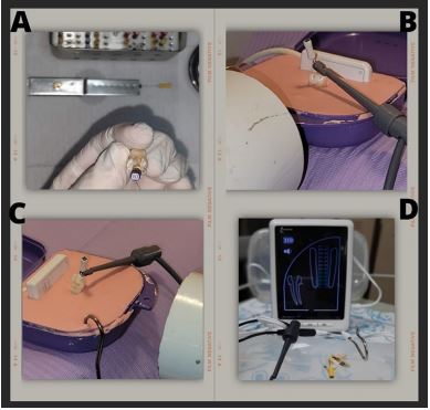 Representative images of the procedure to take the AWL with each of the selected techniques. A) Catheterization with a K10 flexofile. B) and C) Plastic containers with alginate for radiographic measurement. D) Propex II&reg; apical locator.