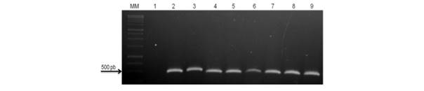 Amplified Cucumber mosaic virus (CMV) RNA from single infections and mixed infection with viruses from the Potyvirus genus in Cucurbita pepo 'Caserta' plants. MM-DNA 1 Kb marker Promega(r); 1- healthy C. pepo; 2- C. pepo inoculated with CMV; 3- C. pepo inoculated with CMV + PRSV-W; 4- C. pepo inoculated with CMV + ZYMV; 5- C. pepo inoculated with CMV + WMV; 6- C. pepo inoculated with CMV + PRSV-W + ZYMV; 7- C. pepo inoculated with CMV + PRSV-W + WMV; 8- C. pepo inoculated with CMV + ZYMV + WMV; 9- C. pepo inoculated with CMV + PRSV-W + ZYMV + WMV. 