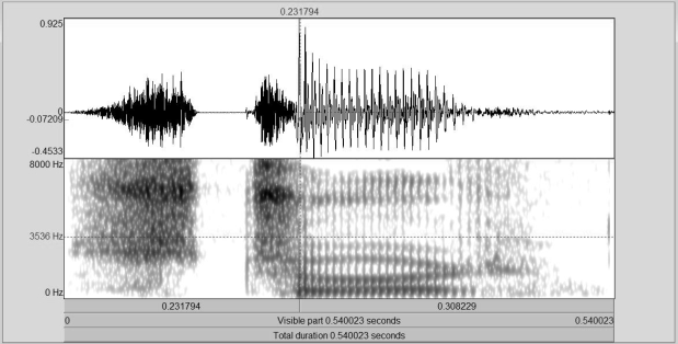  Realiza&ccedil;&atilde;o de [stuɻ] sem elemento voc&aacute;lico entre a fricativa inicial
e a oclusiva alveolar