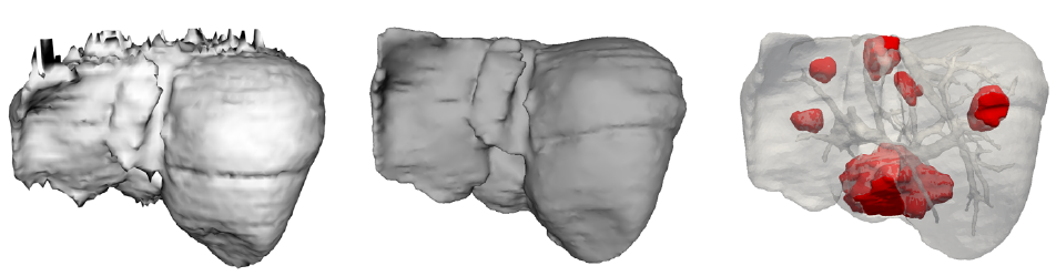 Surface reconstruction
outputs from a segmented image using our method.