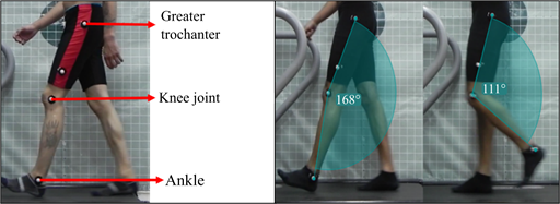 Anatomical points in the study of gait and knee extension and flexion angles