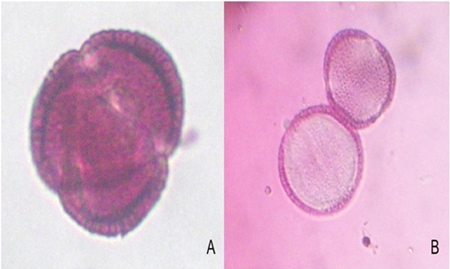A) grano de polen viable en nochebuena; y B) grano de polen no viable, observados a 10 dioptr&iacute;as. 