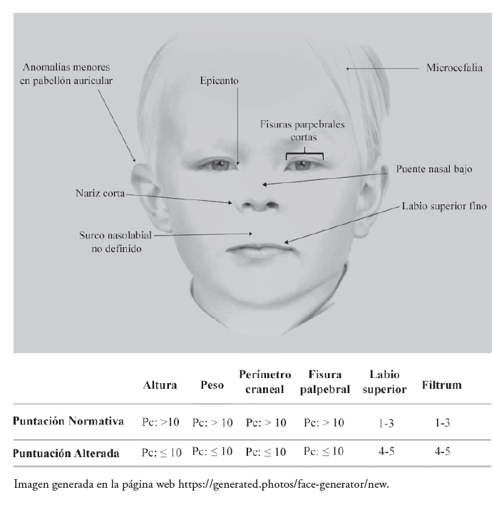 Rasgos dism�rficos protot�picos del trastorno del espectro alcoh�lico fetal