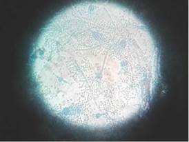 Aspecto microscópico de Aspergillus, obtenido de un cultivo de suelo de los tratamiento 2 y 4 