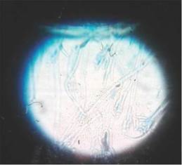 Aspecto microscópico de Trichoderma sp. obtenido de un cultivo de suelo de los tratamiento 2 y 4 