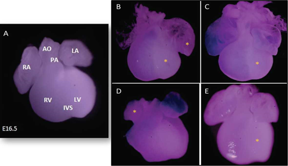 Corazones fetales de rata Wistar estadio E16.5. (0.55X) A. Corazón fetal proveniente del grupo control con características externas normales. RA: atrio derecho. RV: ventrículo derecho. IVS: septum interventricular LV: ventrículo izquierdo. LA: atrio izquierdo AO: arteria aorta. PA: arteria pulmonar B-E. Corazones fetales procedentes del grupo obesos con alteraciones marcadas mediante asterisco. B-C-E. Alteraciones en el tamaño del ventrículo izquierdo (hipoplasia ventricular izquierda). B. Hiperplasia del atrio izquierdo. D. Hipoplasia del atrio derecho.
