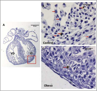 Microfotografías de cortes histológicos de corazón fetal E16.5 a nivel de los ventrículos técnica TUNEL a (100X) A. Corte completo de corazón fetal, con recuadro rojo se indica la región evaluada para la detección de células apoptóticas. Escala de la barra 50 micras. B. Células inmunomarcadas TUNEL positivas, en ventrículo derecho de un corazón fetal del grupo control. C. Células inmunomarcadas TUNEL positivas, en ventrículo derecho de un corazón fetal del grupo obeso. Las células TUNEL positivas con núcleo color marrón, indicativo del proceso de apoptosis, son señaladas con flechas rojas. VD = ventrículo derecho; VI=Ventrículo izquierdo. Escala de la barra 20 micras.