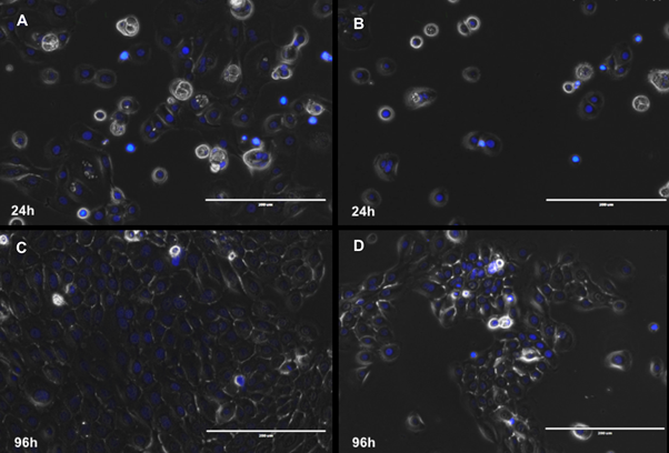 Marcaje de los n&uacute;cleos en azul (Hoechst) de las c&eacute;lulas epiteliales dentales despu&eacute;s de ser cultivadas con SFB 10% (A,C) y SFB 0% (B,D,) a 24 y 96 horas. Barra blanca: 200 μm. 