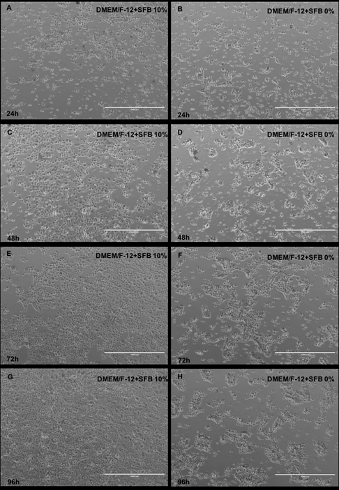 Proliferaci&oacute;n de las c&eacute;lulas epiteliales dentales cultivadas con SFB 10% (A,C,E,G) y SFB 0% (B,D,F,H) a 24,48,72 y 96 horas. DMEM/F12: Dulbecco&rsquo;s Modified Eagle Medium: Nutrient Mixture F-12. SFB: Suero Fetal Bovino. Barra blanca: 1000 μm.