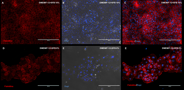 Microfotograf&iacute;as del citoesqueleto mediante inmunofluorescencia de los filamentos de actina (faloidina) de c&eacute;lulas epiteliales dentales a 10% y 0% de SFB. N&uacute;cleos coloreados con DAPI (azul). DMEM/FI2: Dulbecco's Modified Eagle Medium: Nutrient Mixture F-12. SFB: Suero Fetal Bovino. Barra blanca: 200 μm.