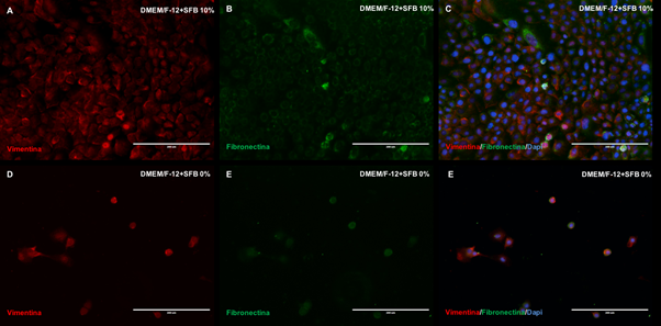 Microfotograf&iacute;as del citoesqueleto y matriz extracelular: Expresi&oacute;n de la vimentina y fibronectina en c&eacute;lulas epiteliales dentales a 10% y 0% de SFB. N&uacute;cleos coloreados con DAPI (azul). DMEM/F12: Dulbecco's Modified Eagle Medium: Nutrient Mixture F-12. SFB: Suero Fetal Bovino. Barra blanca. 200 μm.
