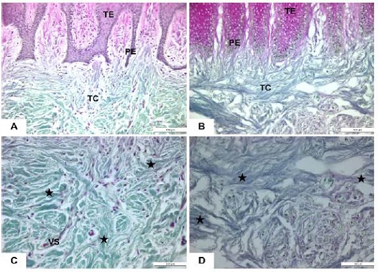 Aspecto histol&oacute;gico del tejido gingival. (A,C) Tejido epitelial y conjuntivo de individuo sano evidenciando la integridad y organizaci&oacute;n celular epitelio-mes&eacute;nquima. (B,D) Queratinizaci&oacute;n, aumento del tejido epitelial y organizaci&oacute;n aleatoria del tejido conjuntivo en pacientes con agrandamiento gingival por ortodoncia. Coloraci&oacute;n de Masson-Goldner. TE: Tejido epitelial; PE: prolongaci&oacute;n epitelial; TC: Tejido conjuntivo; VS: vasos sangu&iacute;neos. Estrella negra: fibras de col&aacute;geno. Barra blanca: 100 &micro;m. 