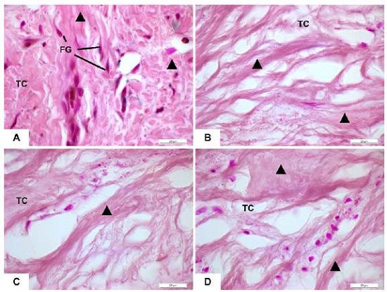 Tejido conjuntivo de enc&iacute;a de pacientes sanos y con Agrandamiento Gingival por ortodoncia. (A) Tejido conjuntivo (TC) de individuo sano muestra abundante presencia de fibroblastos gingivales (FG) rodeados de fibras compactas. (B,C,D) Escasa presencia de fibroblastos gingivales en tejido conjuntivo de pacientes con agrandamiento gingival por ortodoncia. Coloraci&oacute;n Orce&iacute;na. Triangulo negro: haces de fibras en el TC gingival. Barra blanca: 20 &micro;m. 