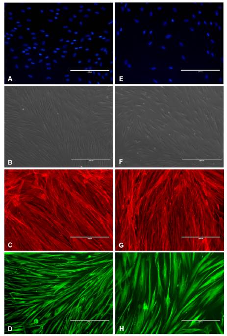 Fenotipo de fibroblastos gingivales. (A, B, C, D) N&uacute;cleos (DAPI), aspecto morfol&oacute;gico, filamentos de actina (rojo) y vimentina (verde) de fibroblastos gingivales de individuos sanos y de pacientes con agrandamiento gingival por ortodoncia (E,F,G,H). Barra blanca: 200 &micro;m.