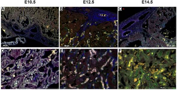 Expresi&oacute;n de DIO3 en la placa cori&oacute;nica y en la zona del laberinto. A, B y C: se observa una porci&oacute;n de la placa cori&oacute;nica y la zona del laberinto. N&oacute;tese la inmunomarcaci&oacute;n de DIO3 (rojo) en el trofoblasto, m&aacute;s intensa en el estadio 12.5 y la fuerte marcaci&oacute;n de actina de m&uacute;sculo liso (azul) en la placa cori&oacute;nica. D, E y F: zona del laberinto a un mayor aumento. Se puede detallar el endotelio de las vellosidades cori&oacute;nicas gracias a la inmunomarcaci&oacute;n de CD34 (verde). Aumento 10X (A), 20X (B, C), 40X (D, E, F). Barra de escala = 100 μm.