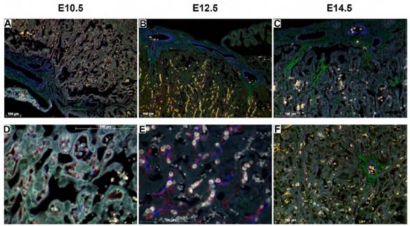 Expresi&oacute;n de TTR en la placa cori&oacute;nica y en la zona del laberinto. A, B y C: se aprecia parte de la placa cori&oacute;nica y la zona del laberinto. D, E y F: se observa la zona del laberinto en mayor detalle. N&oacute;tese la expresi&oacute;n de TTR (verde), actina de m&uacute;sculo liso (azul) y CD31 (rojo). Aumentos 10X (A, B), 20X (C, F), 40X (D, E). Barra de escala = 100 μm.