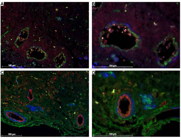 Expresi&oacute;n de DIO3 y TTR por fuera de la placenta. A y B: se detalla la expresi&oacute;n de DIO3 (rojo) en c&eacute;lulas del estroma del &uacute;tero. Actina de m&uacute;sculo liso (azul), CD34 (verde). C y D: se aprecia la expresi&oacute;n de TTR (verde) en el estroma del &uacute;tero, as&iacute; como el m&uacute;sculo liso (azul) de la t&uacute;nica media de vasos sangu&iacute;neos medianos y grandes y el endotelio marcado con CD3I (rojo). Aumentos 20X (A, C) y 40X (B, D). Barra de escala = 100 μm.